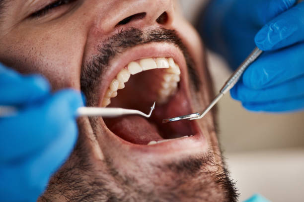 Best Emergency Cosmetic Dentistry (e.g., broken veneers) in Harbour Heights, FL